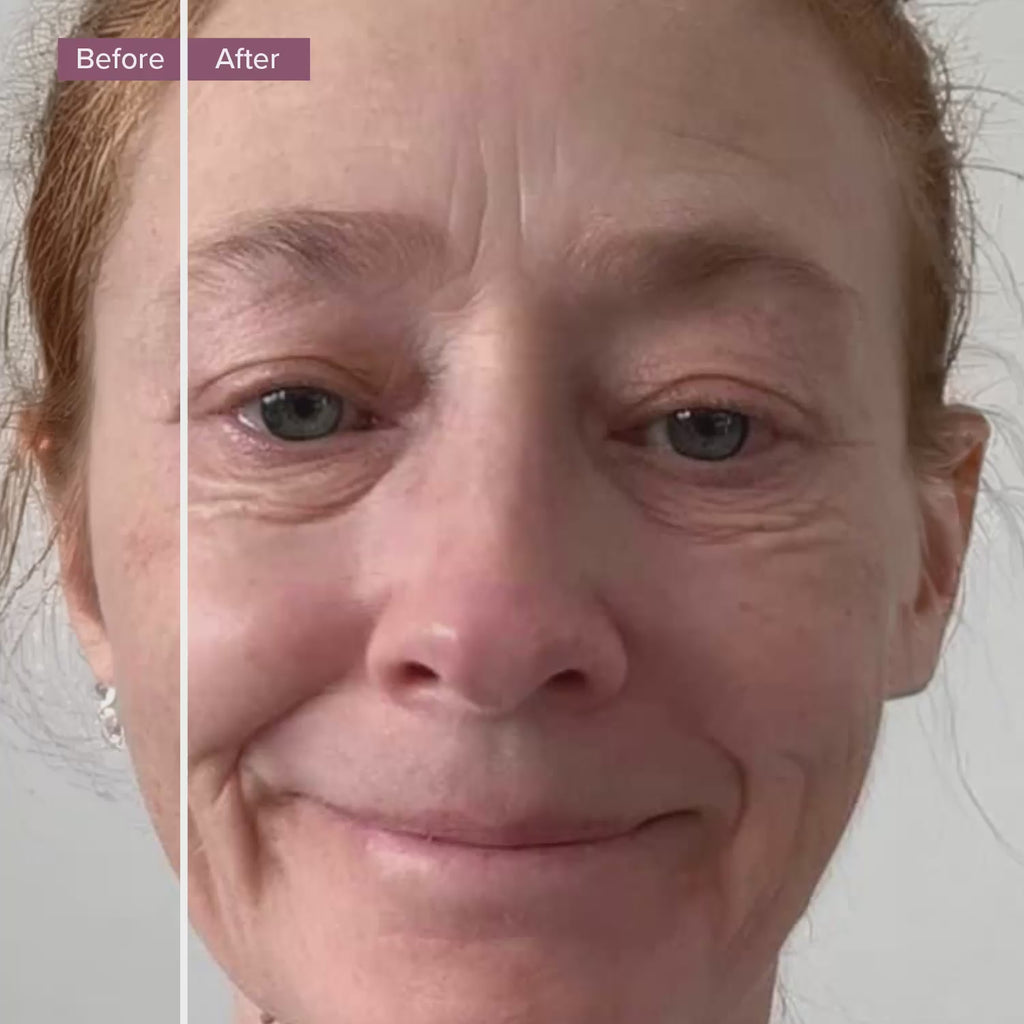 image with a moving slider showing a before and after result on a lady's eyes