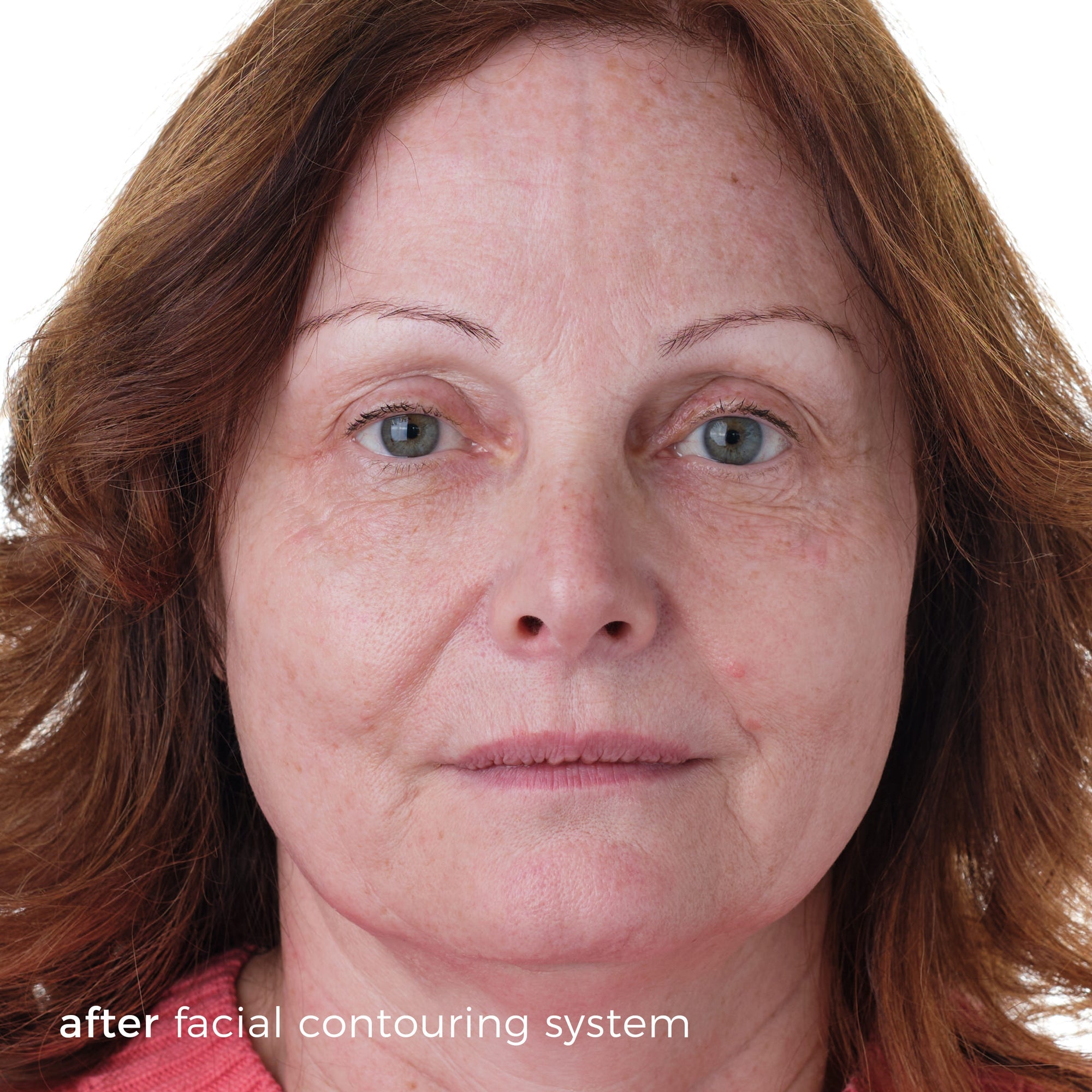 Skinbunny Facial Contouring System – Skin Bunny UK